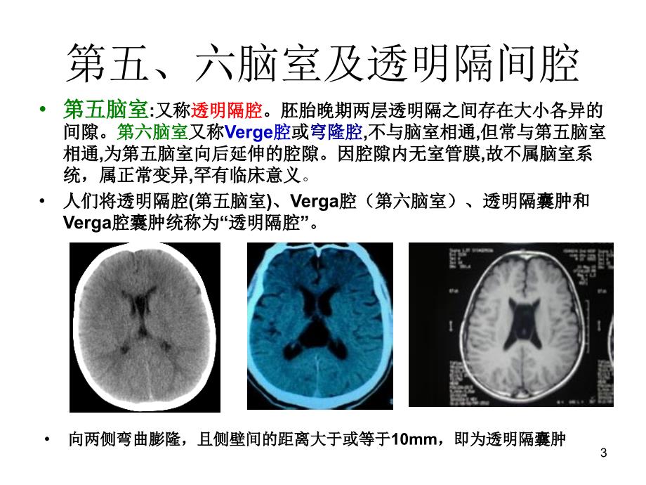 脑室系统及脑脊液循环-文档资料_第3页