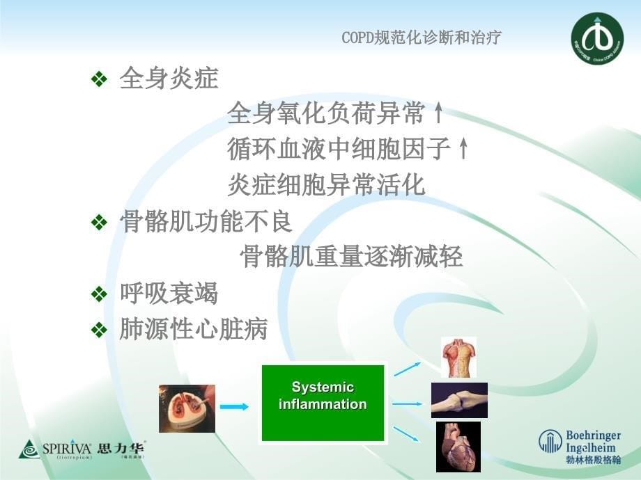 COPD的定义和发病机制-文档资料_第5页