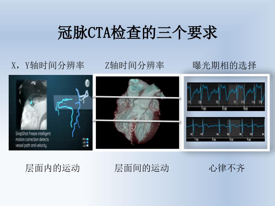 CT冠状动脉成像技术_第3页