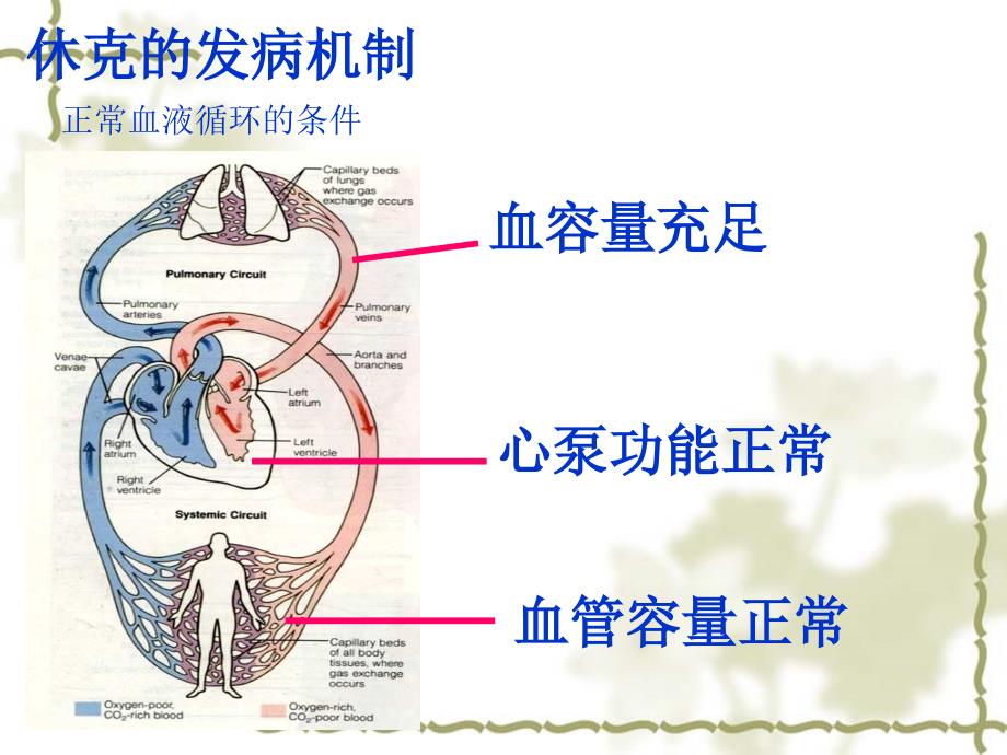 1259编号休克的分类及抢救_第4页