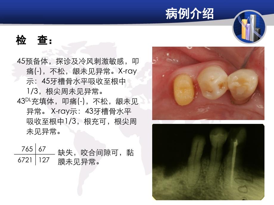 修复病例汇报 NJ_第3页