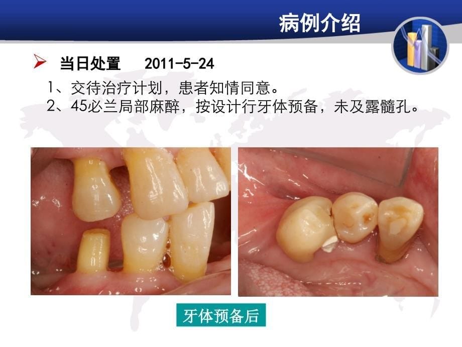 修复病例汇报 NJ_第5页