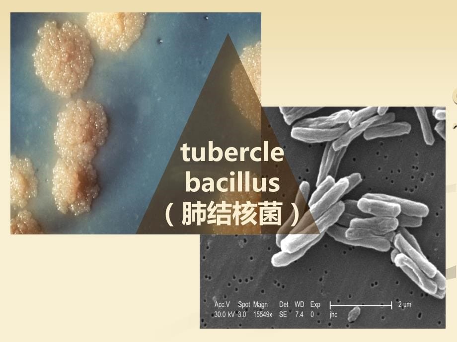 肺结核英文介绍PPT_第5页