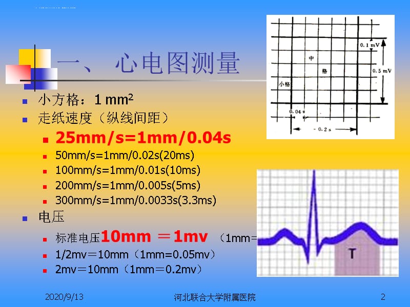 第二节 心电图的测量与正常数据课件_第2页