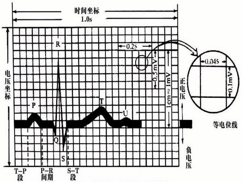 第二节 心电图的测量与正常数据课件_第4页