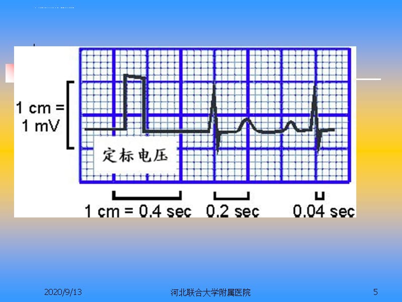 第二节 心电图的测量与正常数据课件_第5页