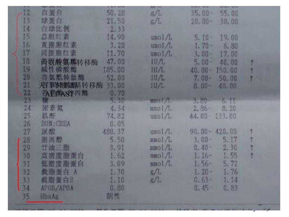 肝脏病常用实验室检查PPT_第3页