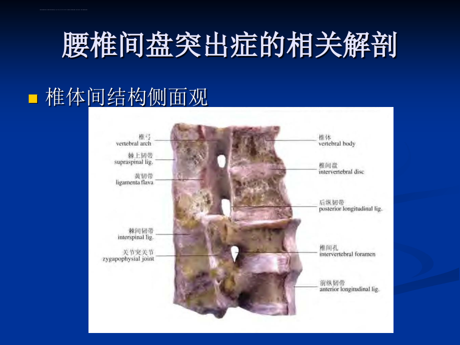 (陈院长)腰椎间盘突出症的诊断、鉴别诊断与分型课件_第4页