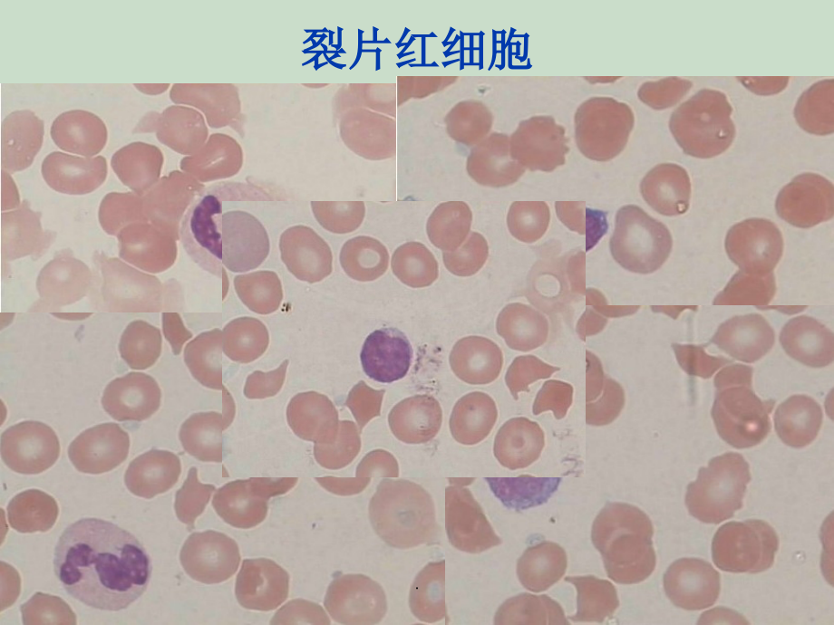 血液图谱之红细胞系ppt课件_第2页