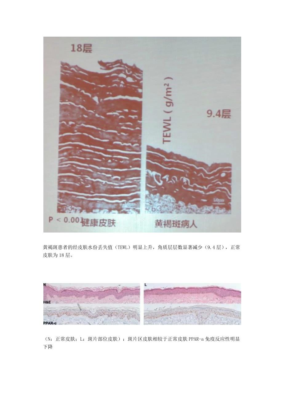 去黄褐斑的最佳方法你知道的也许都是错的!.docx_第3页