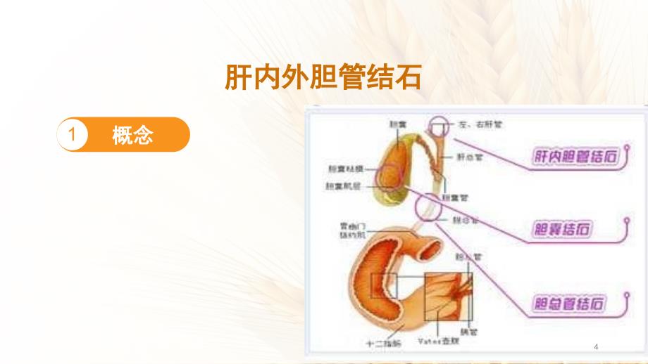 （优质医学）肝内外胆管结石 护理_第4页