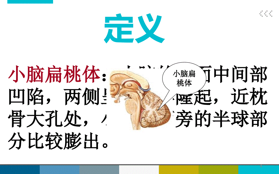 （优质医学）小脑扁桃体下疝畸形_第4页