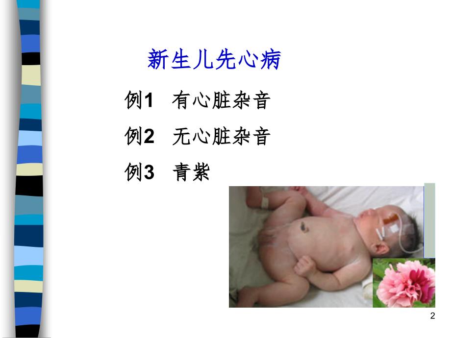 新生儿先天性心脏病病例讨论（课堂PPT）_第2页