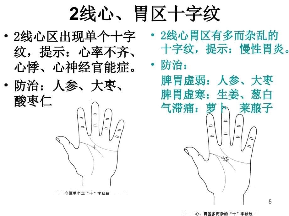 （优质医学）八种异常病理纹_第5页