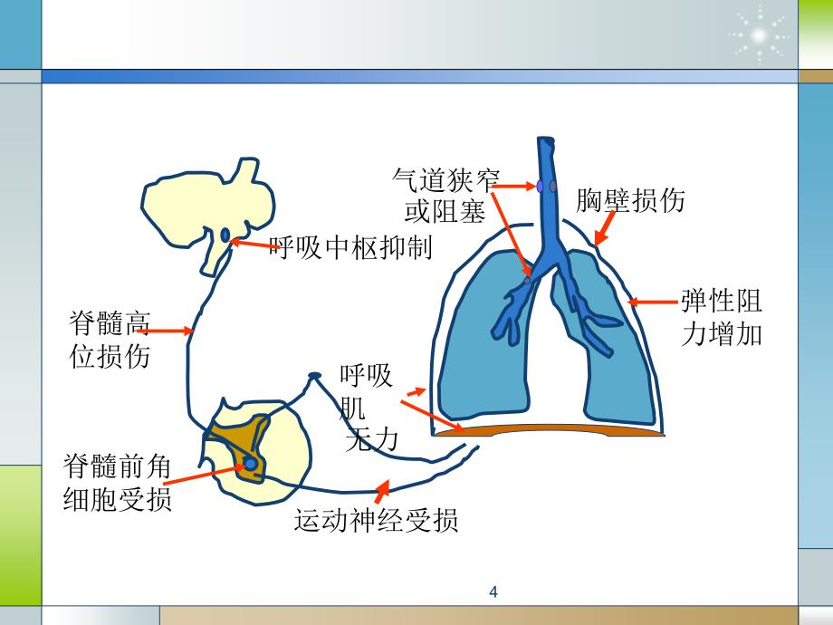 （优质课件）呼吸机的撤离与拔管_第4页