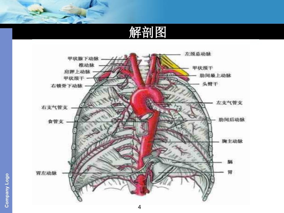 （优质医学）主动脉夹层护理查房_第4页