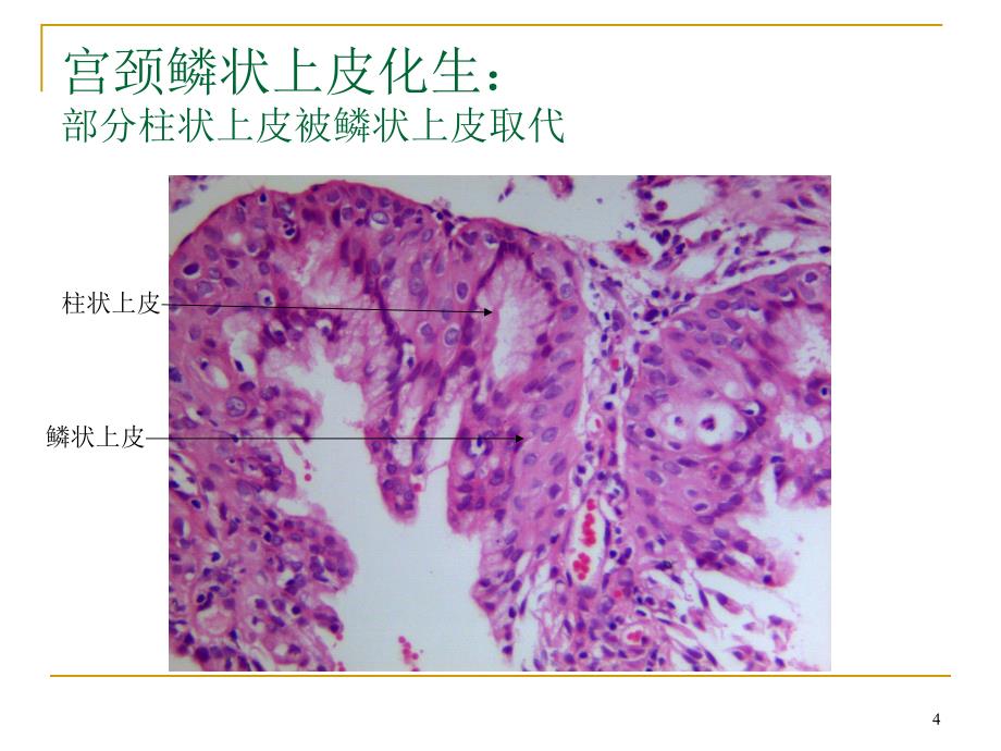 （优质医学）病理学切片图片库_第4页