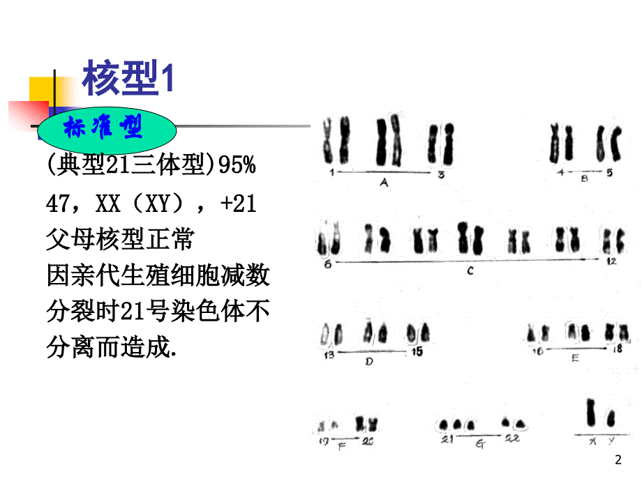 （优质医学）唐氏筛查21三体综合征_第2页