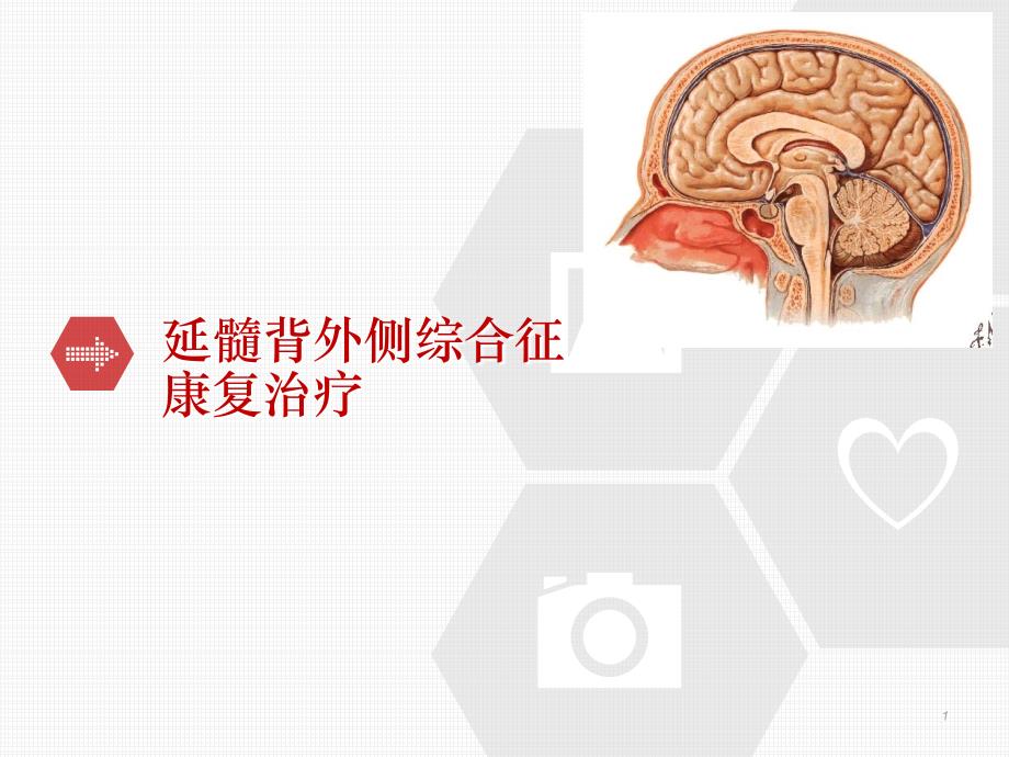 （优质医学）延髓背外侧综合征的康复治疗_第1页