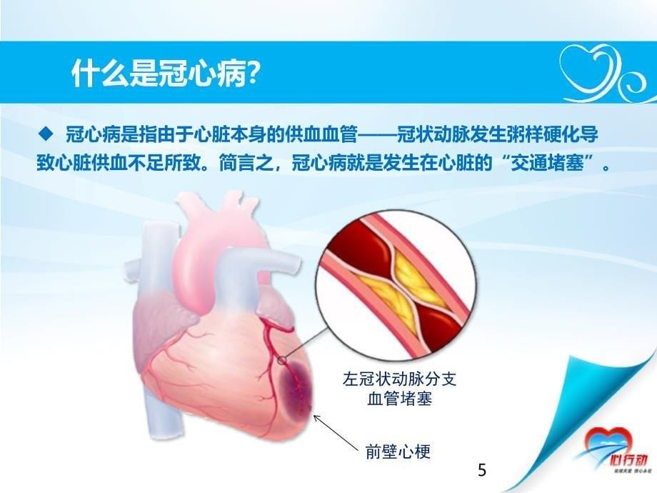 （优质医学）冠心病患者健康教育_第5页