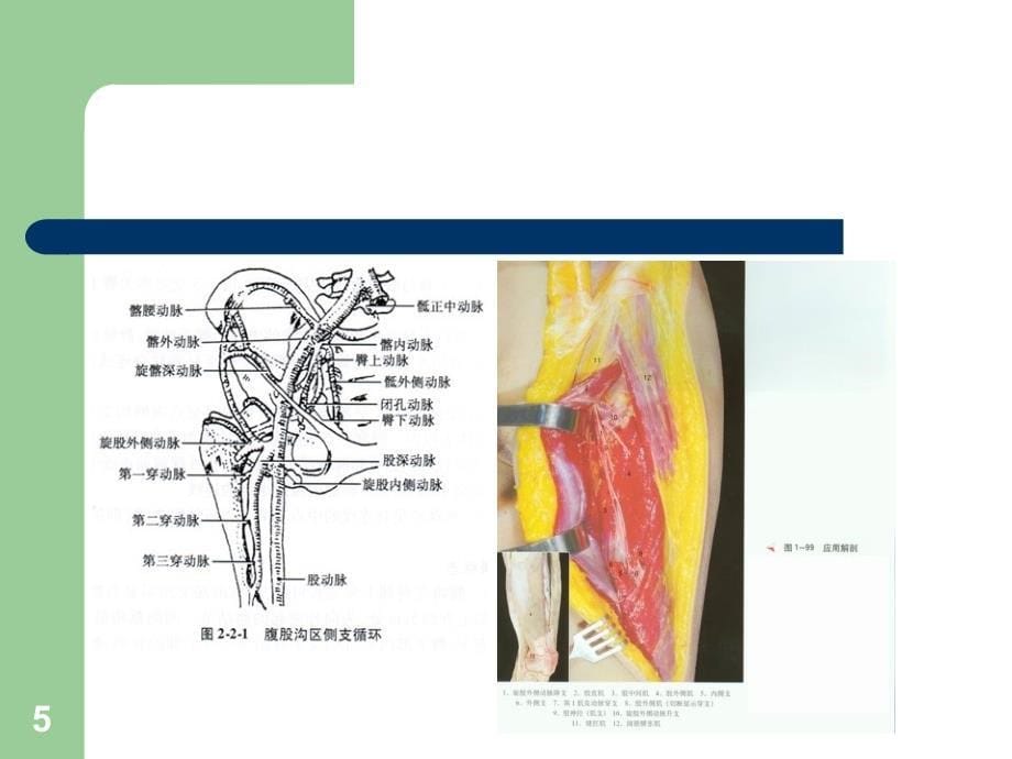 （优质医学）股前外侧皮瓣_第5页