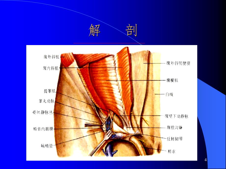 小儿腹股沟斜疝（课堂PPT）_第4页