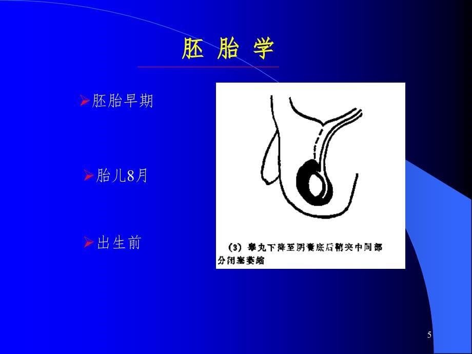 小儿腹股沟斜疝（课堂PPT）_第5页