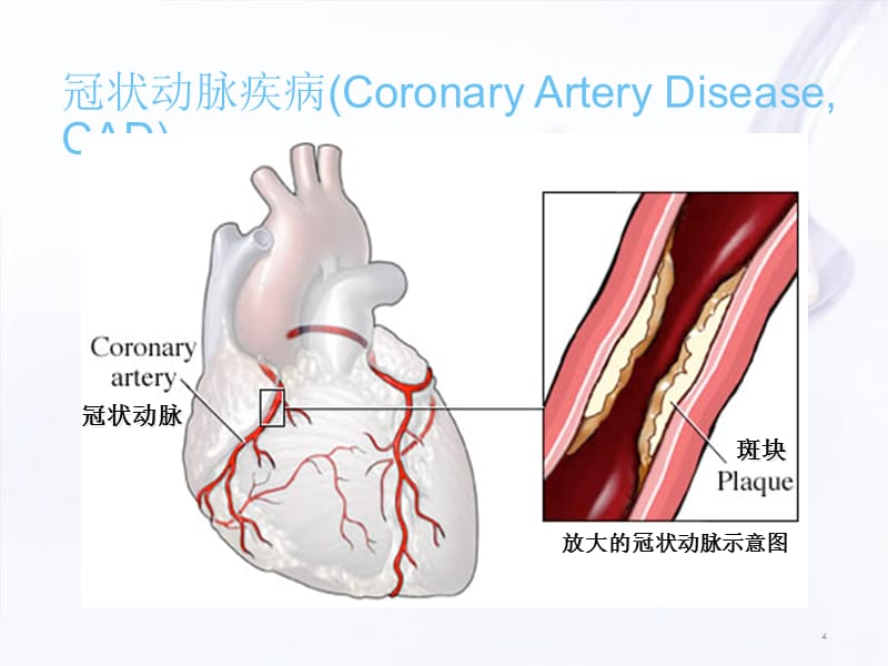 （优质医学）雅培心脏标志物_第4页