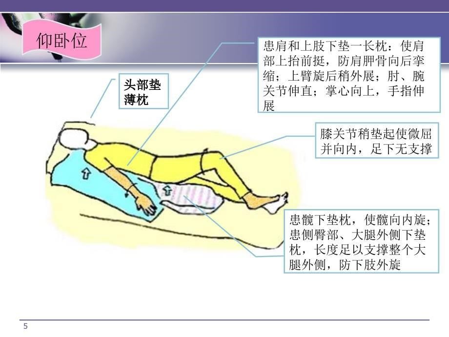 （优质医学）脑卒中康复病人良肢位摆放_第5页