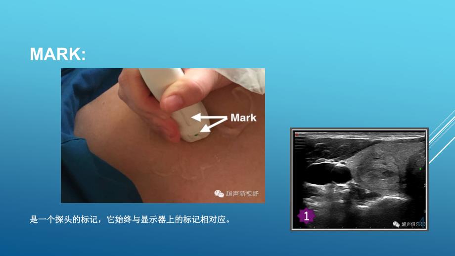 （优质医学）超声基础培训_第4页
