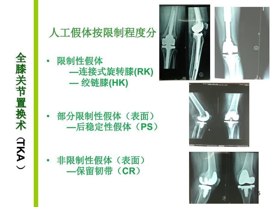 （优质医学）膝关节置换术后的功能锻炼_第5页