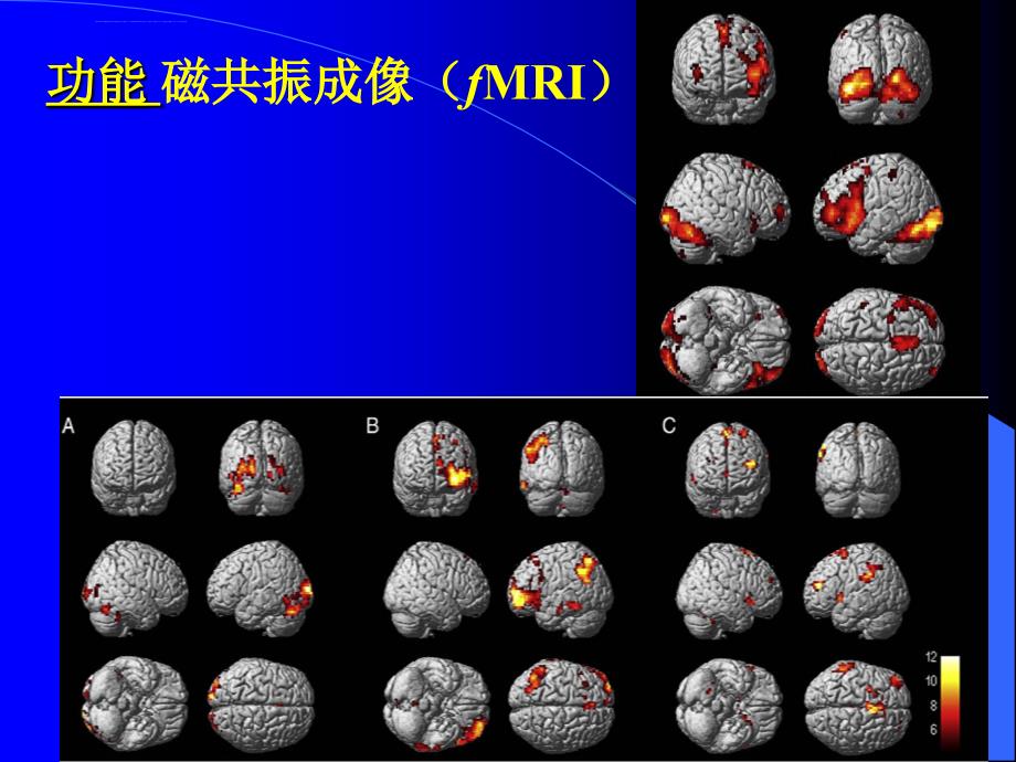 北师大fMRI【第一章-概述】课件_第4页