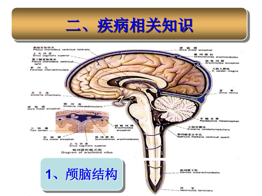 {精品}蛛网膜下腔出血的护理查房._第3页