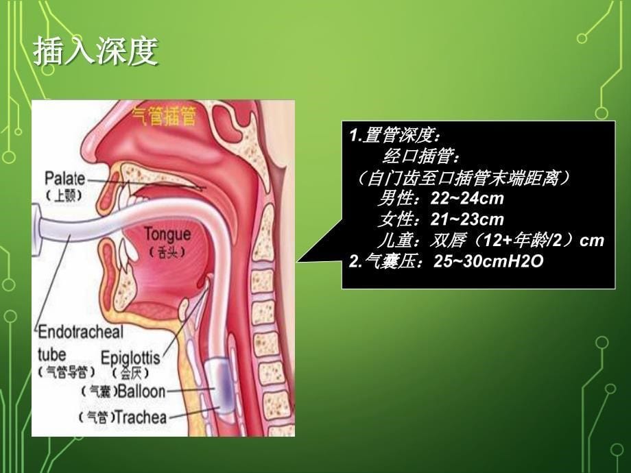 经口气管插管的固定PPT_第5页