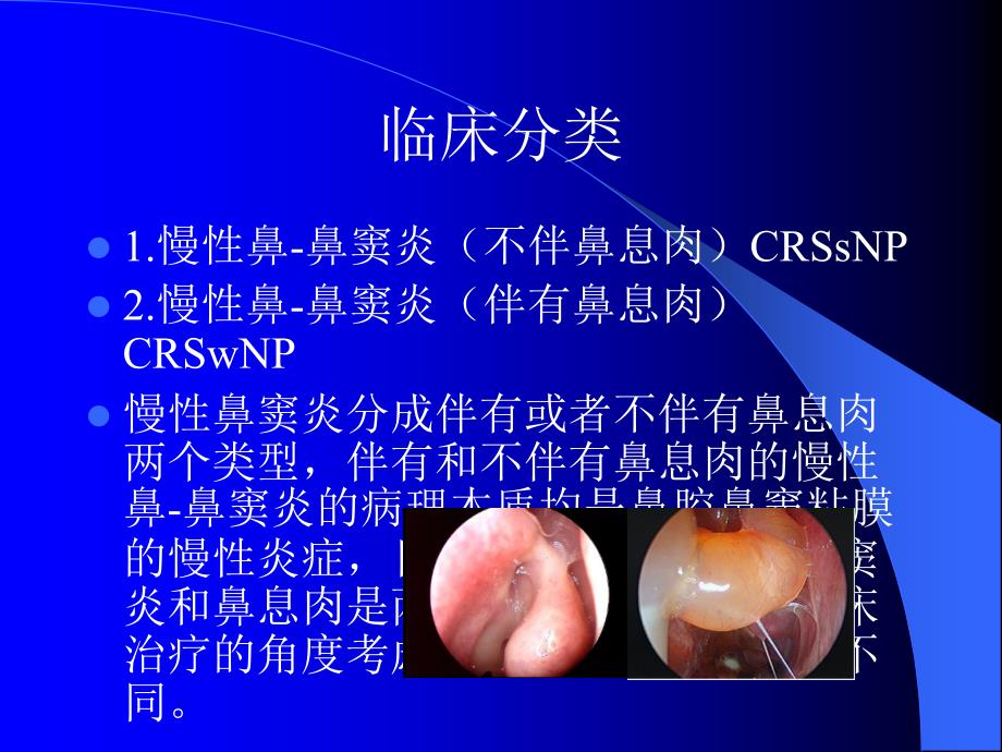 慢性鼻-鼻窦炎诊治及预后PPT_第3页