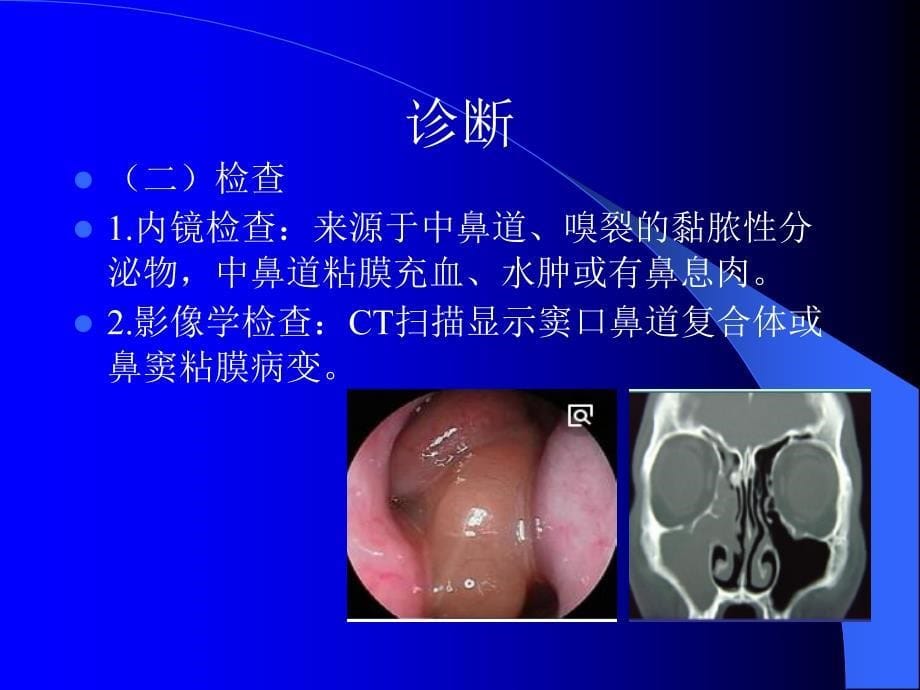 慢性鼻-鼻窦炎诊治及预后PPT_第5页