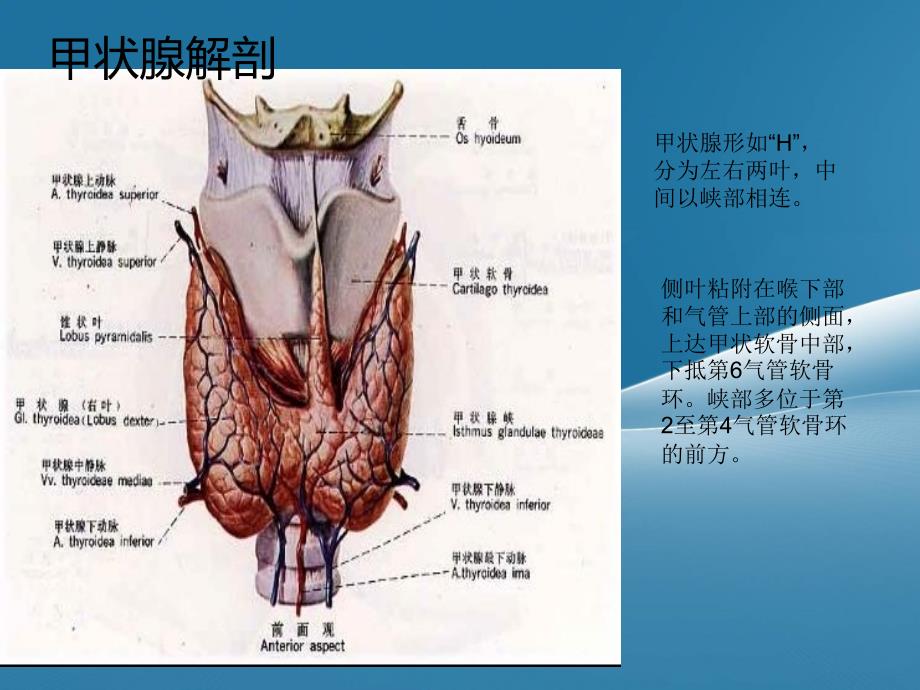 甲状腺常见疾病CT诊断PPT_第2页