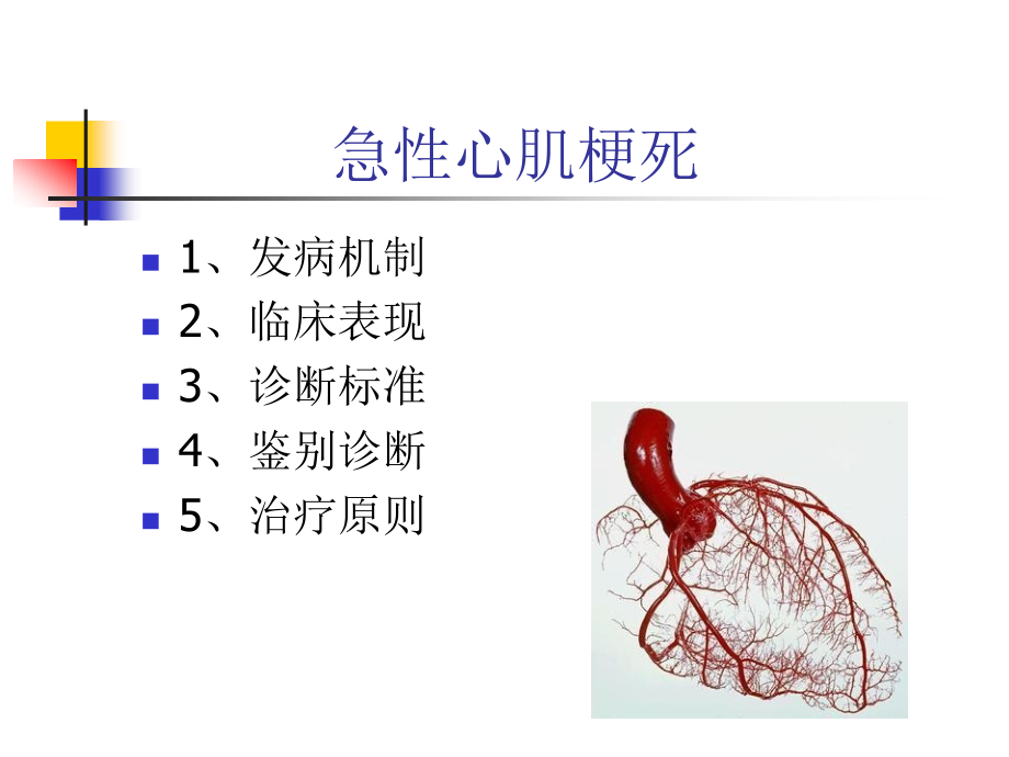 759编号急性心肌梗死课件_第2页