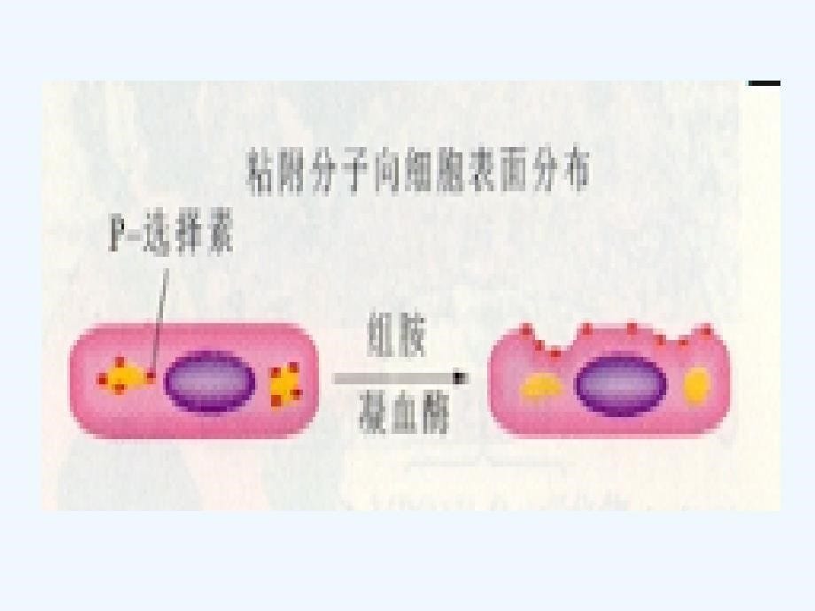 病理炎症图片_第5页