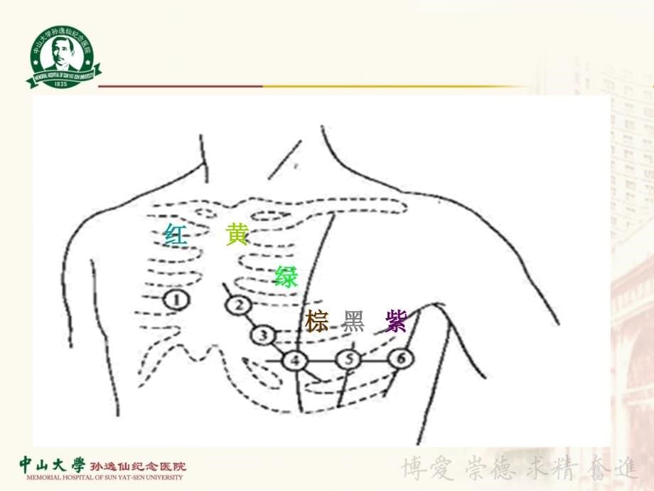 心电图基本常识-_第5页