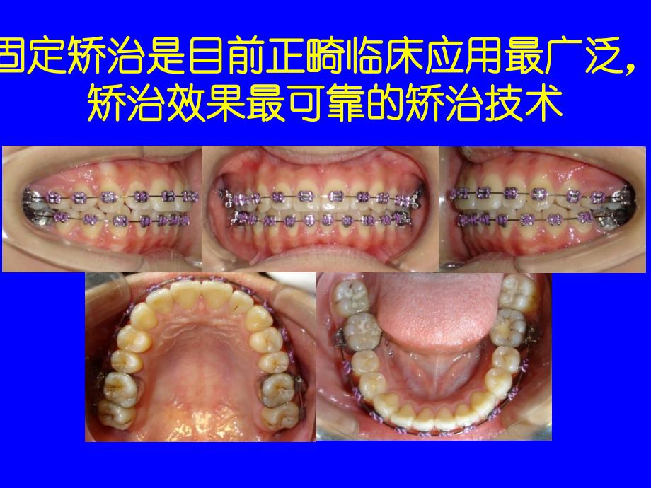 口腔正畸基础学-_第2页