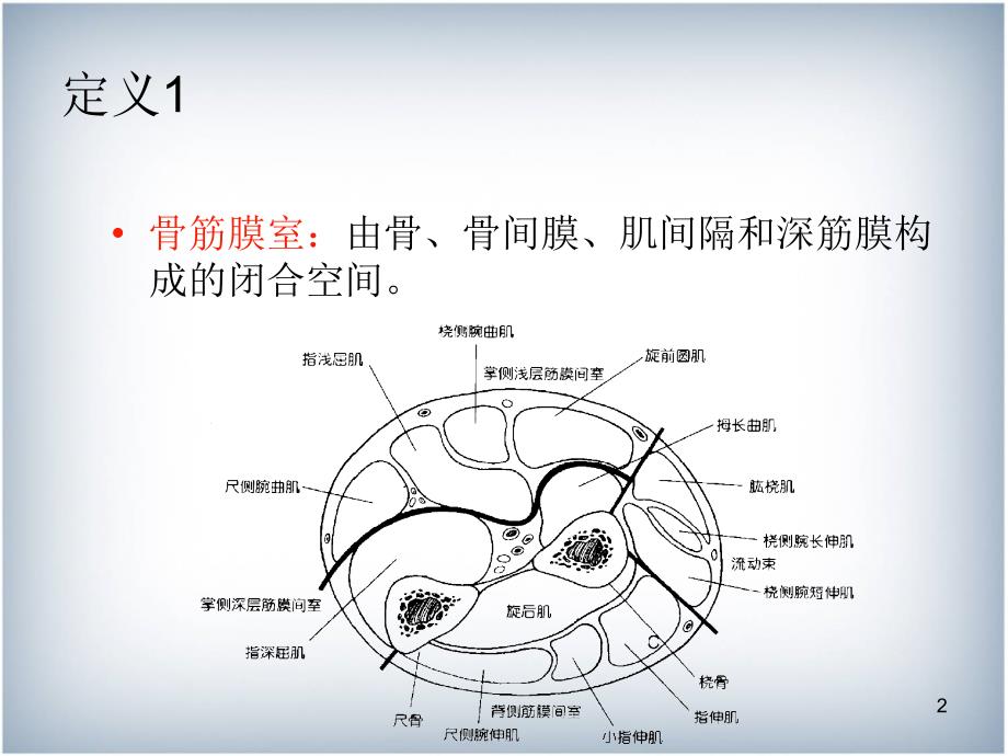 骨筋膜室综合征新版本_第2页