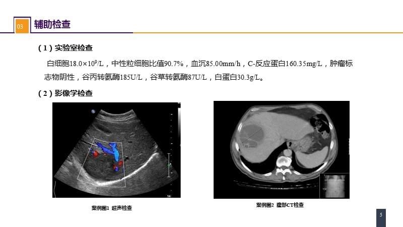 外科学-第三十八章 肝疾病 案例分析-肝脓肿_第5页