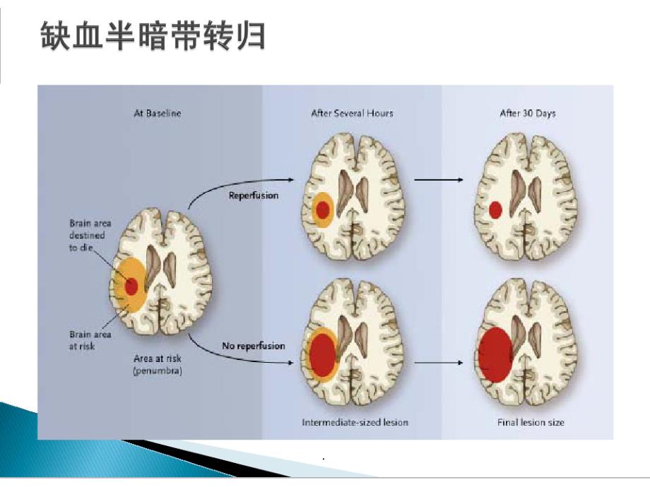 急性脑卒中绿色通道路径最新版本_第3页