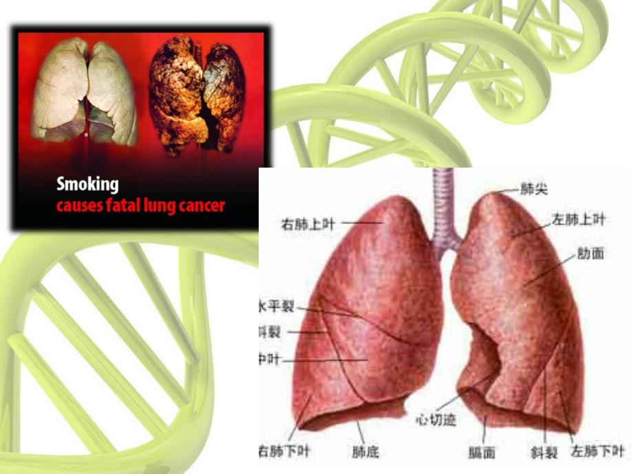 （优质医学）左上肺癌根治术_第3页