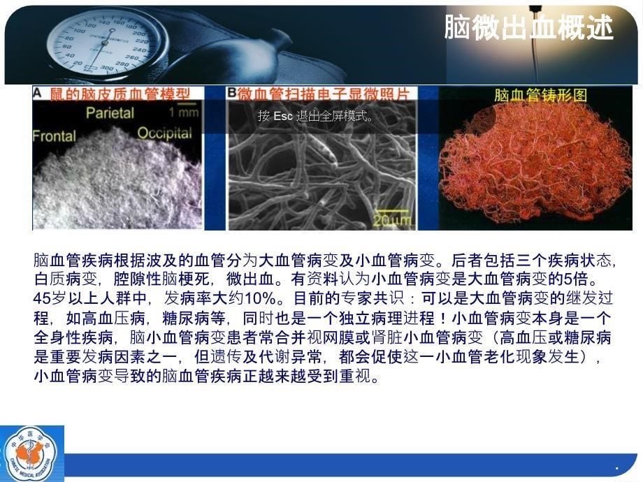 脑微出血ppt课件_第5页