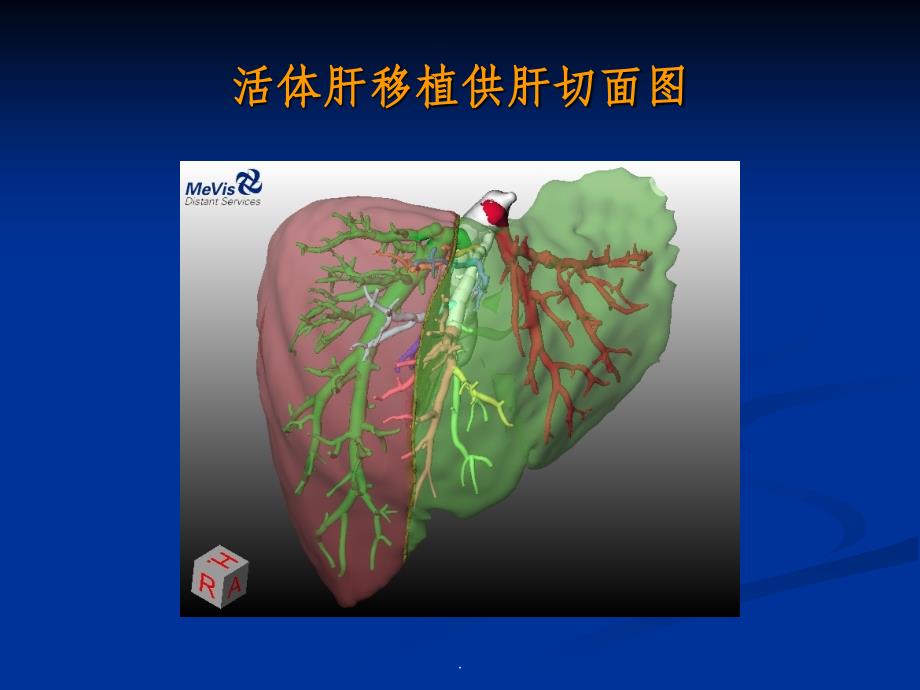 外科学总论之器官移植ppt课件_第4页