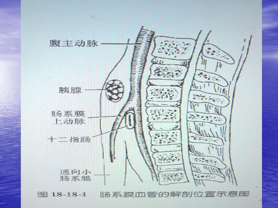 肠系膜上动脉综合征医学幻灯片_第4页