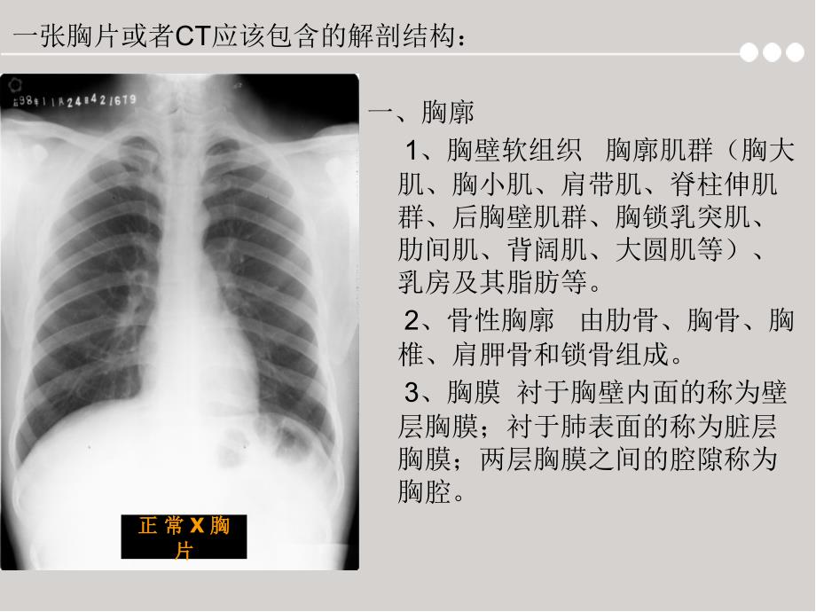 胸片及胸部CT的阅读内容及肺段定位幻灯片_第2页