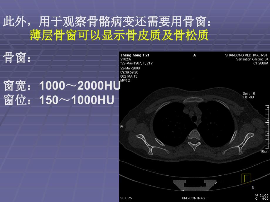 正常胸肺部CT影像学表现幻灯片_第3页